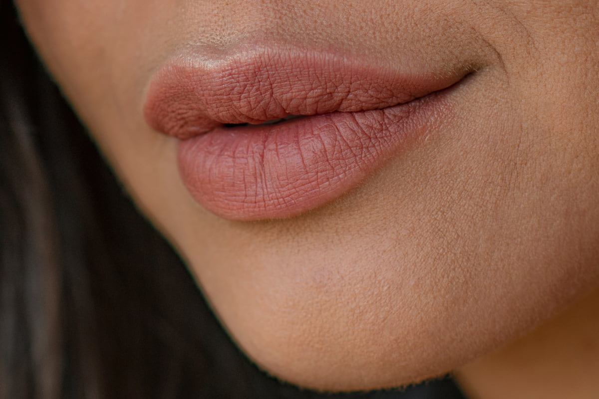 Lip fillers, how long does the effect last?