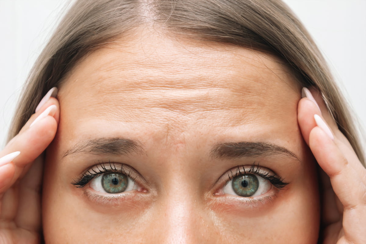 Forehead wrinkles, what is the most effective remedy?